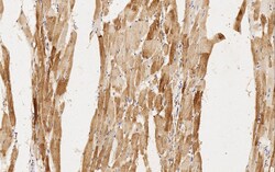 Abcam Mouse monoclonal [3-48 G5C7] to MYH6, Quantity: Each of 1