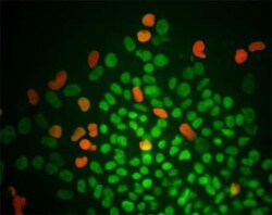 Abcam Rabbit polyclonal to Oct4, Quantity: Each of 1