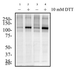 Abcam Rabbit polyclonal to IRE1 (phospho S724), Quantity: Each of 1