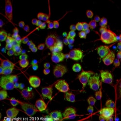 Abcam Rabbit polyclonal to liver Arginase, Quantity: Each of 1