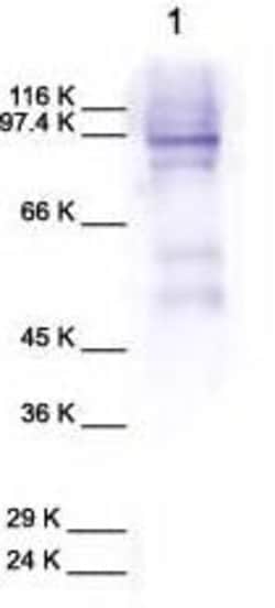Abcam Rabbit polyclonal to MMP9, Quantity: Each of 1