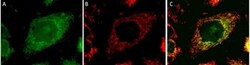 Abcam Alexa Fluor 488 Mouse monoclonal [8F6AE9] to CPT1A, Quantity: Each