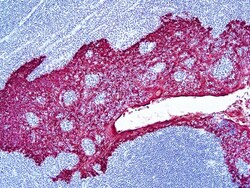 Diagnostic Biosystems&nbsp;HRP PERM RED CHROMOGEN - 30MLS PermaRed&trade;/HRP