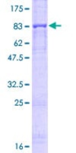 Abcam Recombinant Human Perforin protein, 10UG, Quantity: Each of 1