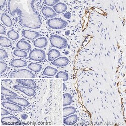 Abcam Rabbit polyclonal to LYVE1, Quantity: Each of 1