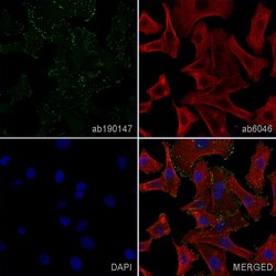 Abcam Mouse monoclonal [LM609] to Integrin alpha V beta 3, Quantity: Each
