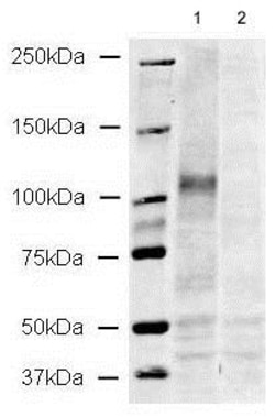 Abcam Rabbit polyclonal to CD133 - Stem Cell Marker, Quantity: Each of