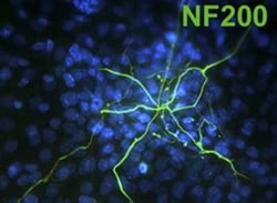 Abcam Chicken polyclonal to Neurofilament heavy polypeptide, Quantity: