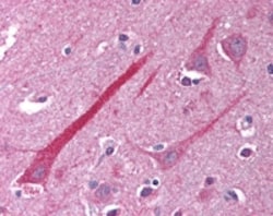 Abcam Rabbit polyclonal to TNFRSF14/HVEM, Quantity: Each of 1