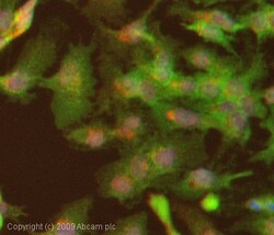 Abcam Rabbit polyclonal to LDL Receptor, Quantity: Each of 1