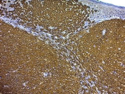 Abcam Mounting Medium for IHC - Aqueous, 125ML