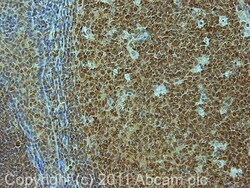 Abcam Rabbit polyclonal to Topoisomerase II beta/TOP2B, Quantity: Each