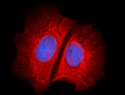 Biolegend Alexa Fluor 647 anti-Cytokeratin (pan reactive), Quantity: Each