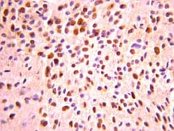 Abcam Rabbit polyclonal to Olig2, Quantity: Each of 1