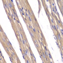 Abcam Rabbit polyclonal to Frataxin, Quantity: Each of 1