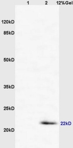 Abcam Rabbit polyclonal to CD69, Quantity: Each of 1
