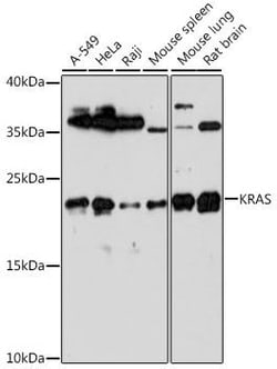 Abcam Rabbit polyclonal to Ras, Quantity: Each of 1