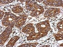 Abcam Rabbit polyclonal to C3a R, Quantity: Each of 1