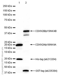 Abcam Rabbit monoclonal [EP435Y-129R] to CDKN2A/p16INK4A +CDKN2B/p15INK4B,