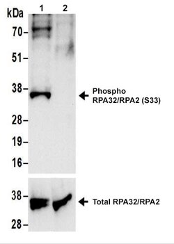 Abcam Rabbit polyclonal to RPA32/RPA2 (phospho S33), Quantity: Each of