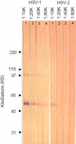 Abcam Mouse monoclonal [2C10] to HSV1 + HSV2 gD, Quantity: Each of 1