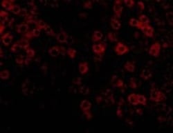Abcam Rabbit polyclonal to Perilipin 3/TIP47, Quantity: Each of 1