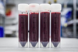Lonza Walkersville Unprocessed Human Bone Marrow, Fresh, 10 mL, Quantity: