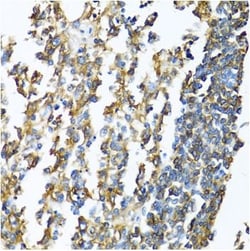 Abcam Rabbit polyclonal to MHC Class II, Quantity: Each of 1
