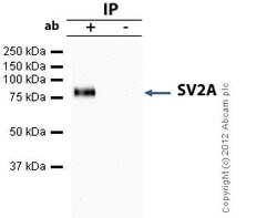 Abcam Rabbit polyclonal to SV2A, Quantity: Each of 1