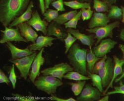 Abcam Rabbit polyclonal to TIMP3, Quantity: Each of 1
