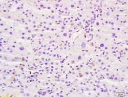 Abcam Rabbit polyclonal to GLB1/Beta-galactosidase, Quantity: Each of 1