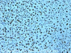 Abcam Rabbit polyclonal to SNF2H, Quantity: Each of 1
