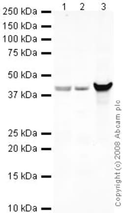 Abcam Rabbit polyclonal to beta Dystroglycan, Quantity: Each of 1