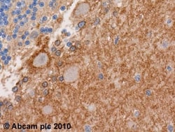 Abcam Rabbit polyclonal to EAAT1, Quantity: Each of 1