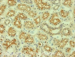 Abcam Rabbit polyclonal to SGLT2, Quantity: Each of 1