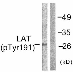 Abcam Rabbit polyclonal to LAT (phospho Y191), Quantity: Each of 1