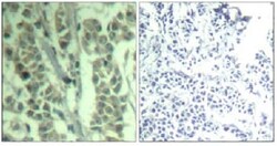 Abcam Rabbit polyclonal to CBL (phospho Y700), Quantity: Each of 1