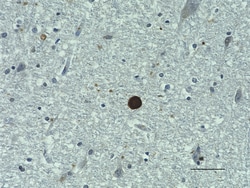 Biolegend Anti-Synuclein-α/β, 130-140, Quantity: Each of 1
