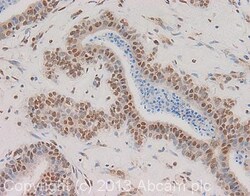 Abcam Rabbit polyclonal to CPSF6, Quantity: Each of 1