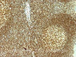 Abcam Rabbit polyclonal to Nucleolin, Quantity: Each of 1