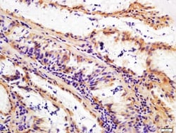 Abcam Rabbit polyclonal to Fibroblast activation protein, alpha, Quantity: