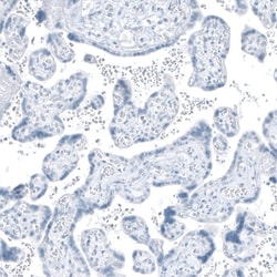 Abcam Rabbit polyclonal to HSD17B13, Quantity: Each of 1