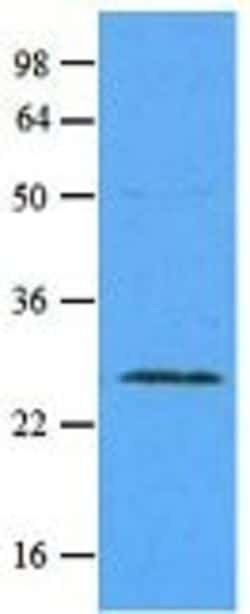Abcam Mouse monoclonal [3A4] to Rab5A - Early Endosome Marker, Quantity: