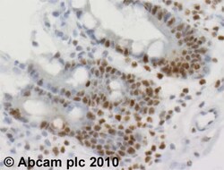 Abcam Rabbit polyclonal to mSin3A - ChIP Grade, Quantity: Each of 1