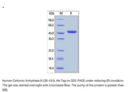 ACROBiosystems Recombinant Protein;Human Carbonic Anhydrase IX / CA9 (38-414)