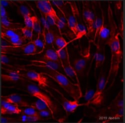Abcam Rabbit polyclonal to VE Cadherin - Intercellular Junction Marker,