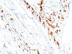 Abcam Mouse monoclonal [O10+C1A/711] to CD1a, Quantity: Each of 1