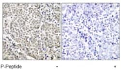 Abcam Rabbit polyclonal to NF-kB p65 (phospho S529), Quantity: Each of