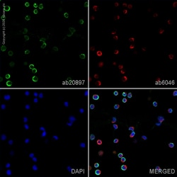 Abcam Mouse monoclonal [B7/21] to HLA-DP, Quantity: Each of 1
