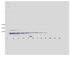 Abcam Rabbit polyclonal to SDF1, Quantity: Each of 1